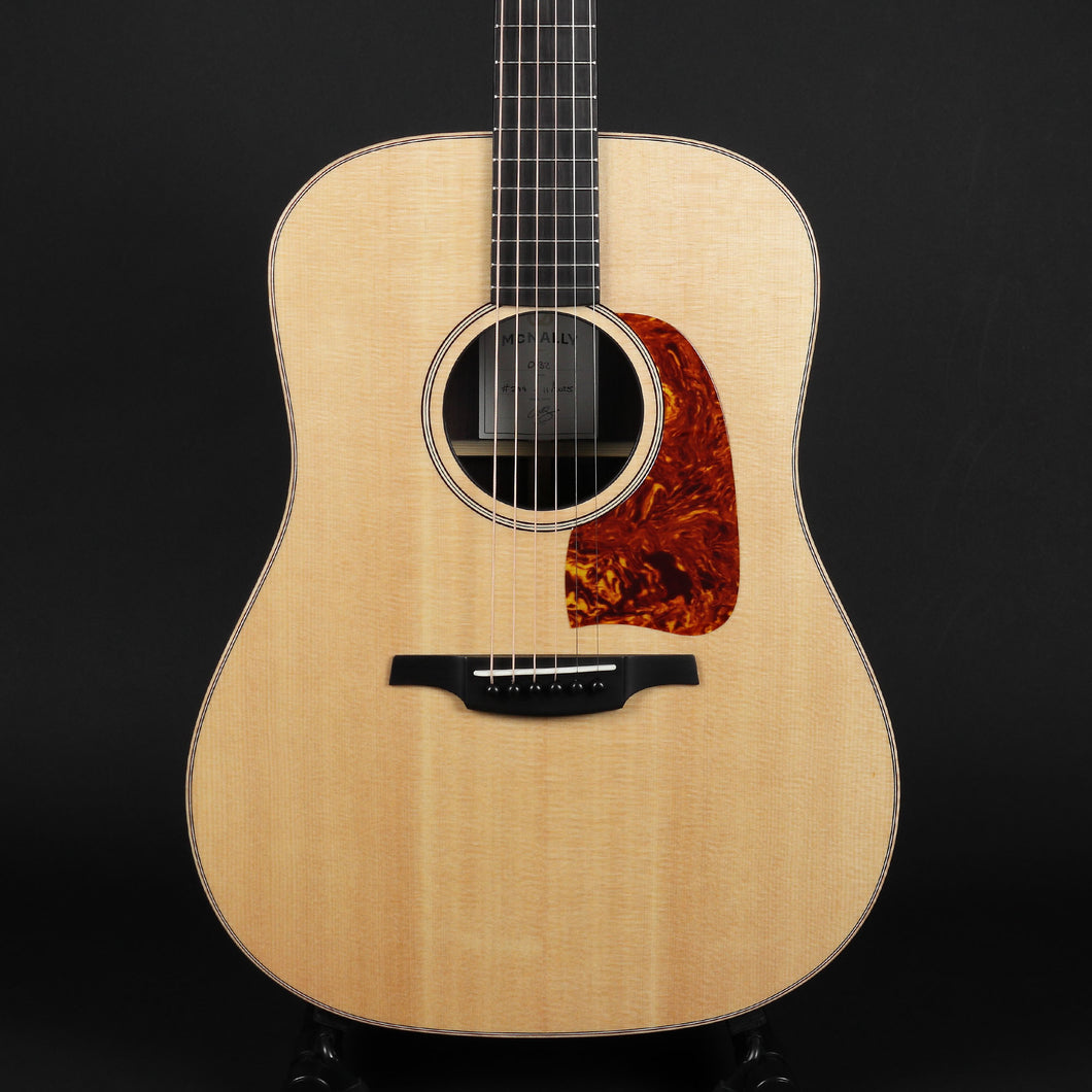 McNally D32 Sitka Spruce/Rosewood #299